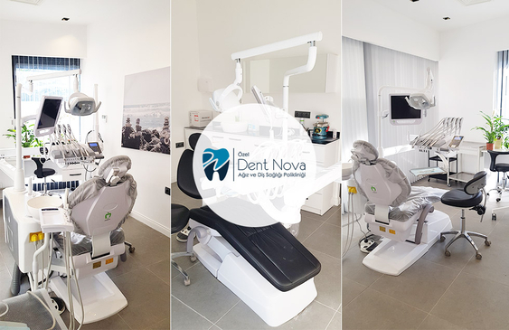 Slider image (3) Dent Nova Dental Clinic